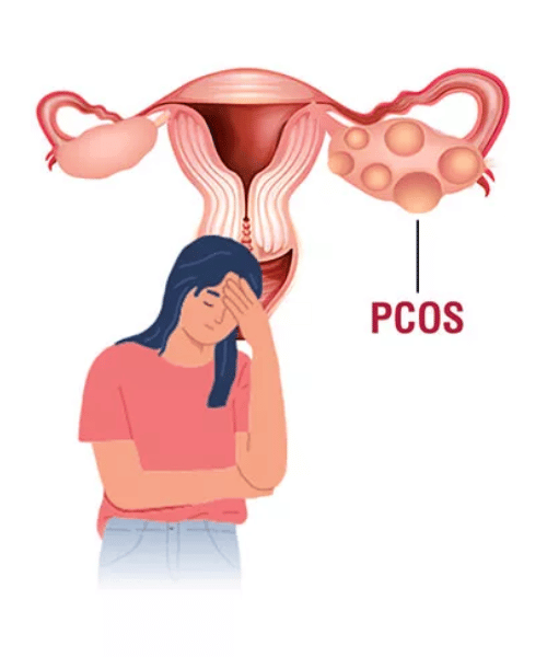 Hormonal Balance Tea